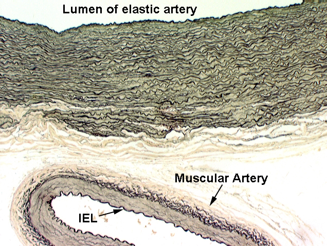 Muscular Artery Vs Elastic Artery Histology Hot Sex Picture